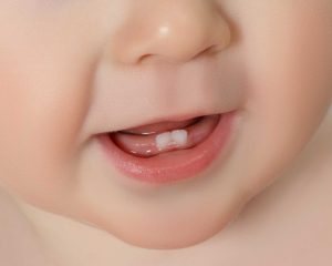 Vauvan suu lähikuvassa, suussa näkyy kaksi alahammasta.