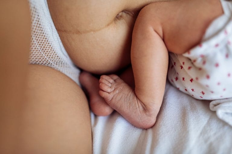 Lähikuva vastasyntyneen imetystilanteesta. Kuvassa näkyy vanhemman mahaa ja verkkohousut sekä vauvan jalat.